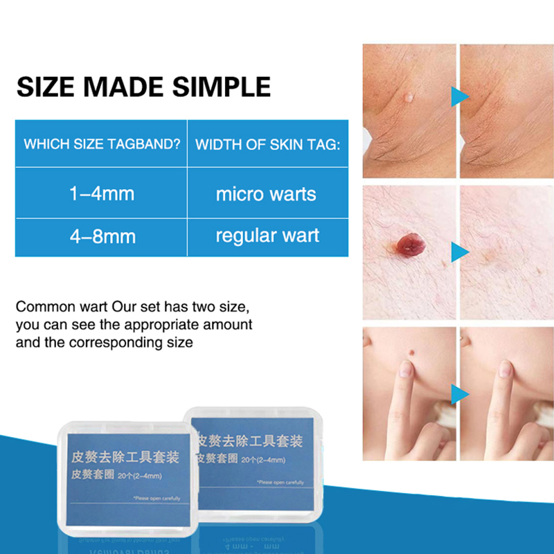 20pcs/Box Flesh Nevus Removal  - Men Accessories Combo 评论和价格